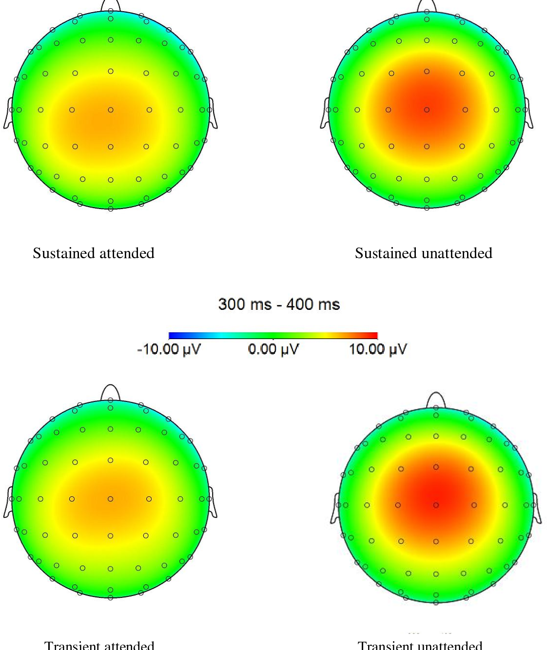 Full paper: https://www.semanticscholar.org/paper/The-difference-between-transient-and-sustained-on-Beker/7b8b9eaf099a1f150374b2ea322d7616536bafeb